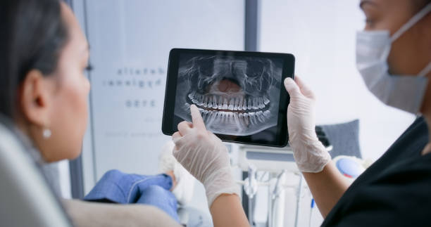 Licensed Tooth Extraction service in Winter Park, FL - Smile Center Dentistry